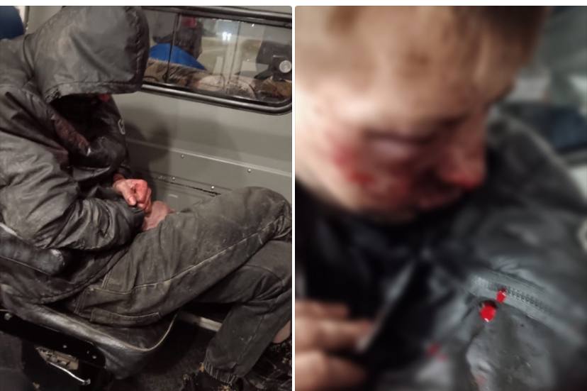 Неизвестные возле школы жестоко избили омича - парень в коме
