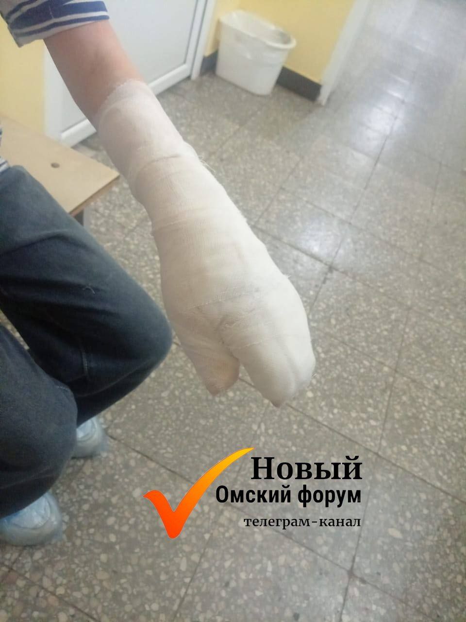 В Омске бойцовская собака напала и покусала 14-летнюю девочку